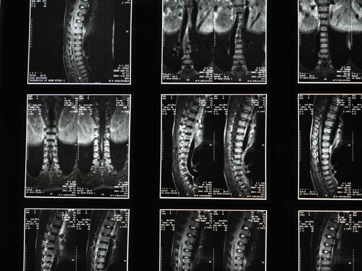 Jangan Pernah Mengabaikan Tubuh Kita Sendiri